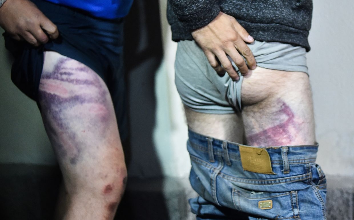 Detainees show signs of beatings as they leave Okrestina prison after opposition rallies in Minsk, Belarus, on Aug. 14, 2020.