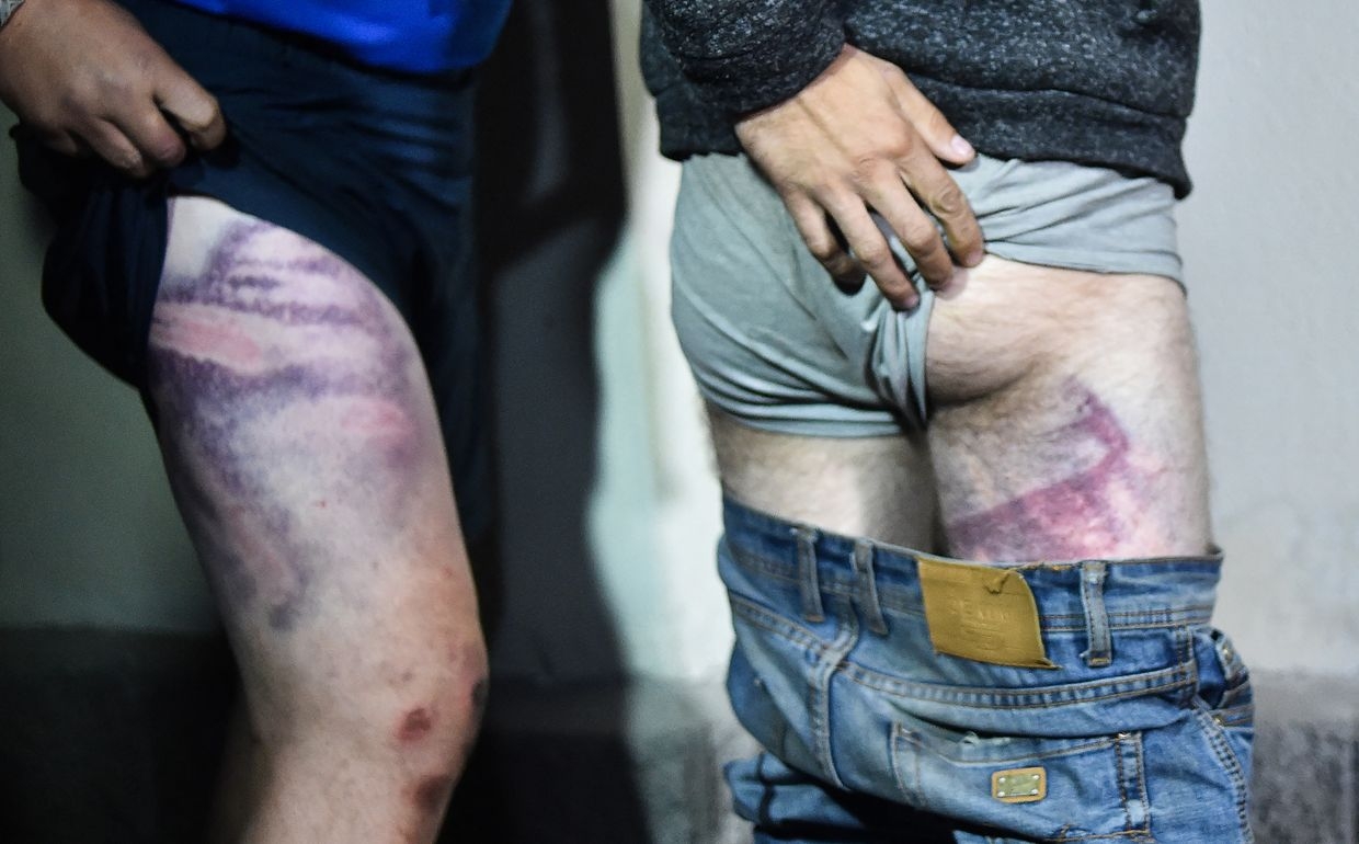 Detainees show signs of beatings as they leave Okrestina prison after opposition rallies in Minsk, Belarus, on Aug. 14, 2020.