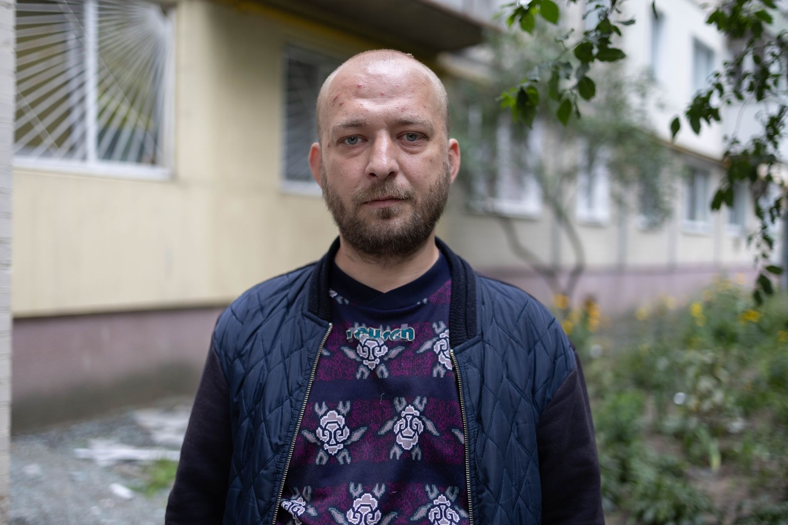 Anton Melnychonok, who was formerly in the army, near the house he lives in that was damaged due to Russian overnight attack in Kyiv, Ukraine on July 31, 2025. 