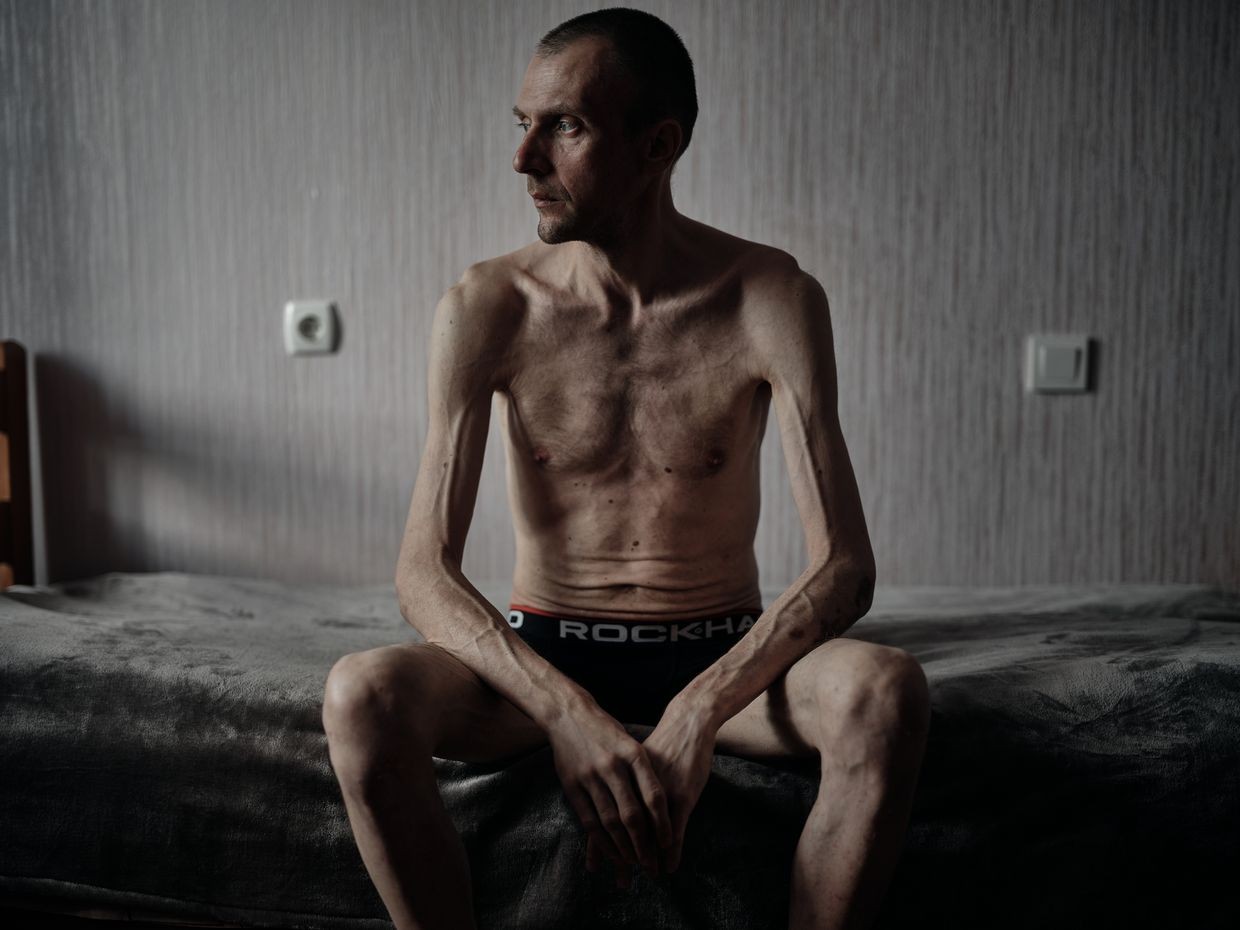 A Ukrainian soldier who was previously held captive in an unspecified location in Ukraine, on June 6, 2024.