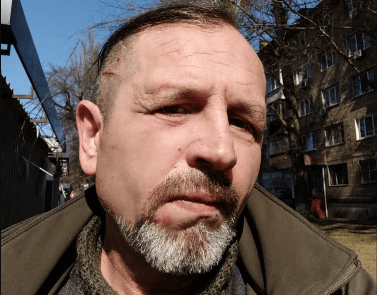 Ukrainian activist, former political prisoner, says he was beaten at Kyiv recruitment center