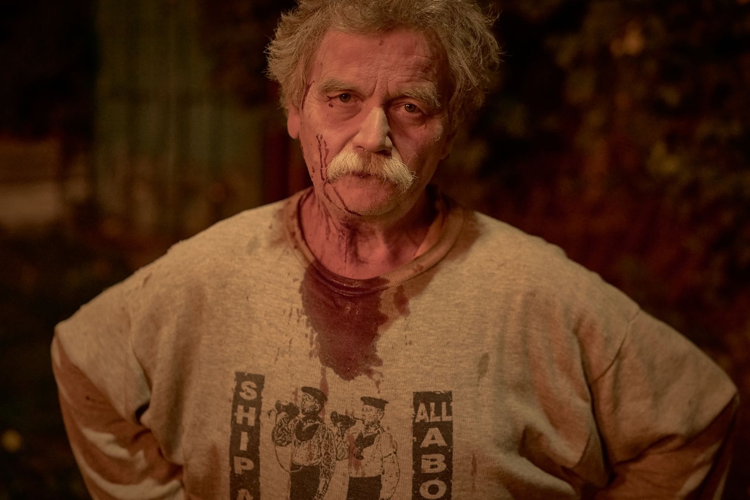 An injured resident poses as a private house burns in Kyiv, Ukraine, on Sept. 27, 2026.